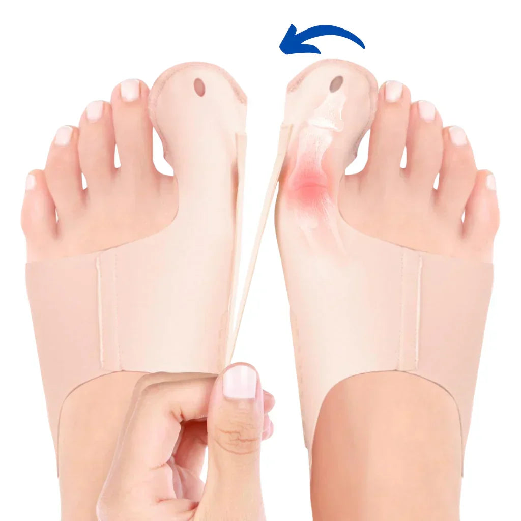 1+1 GRATIS | Hallux Valgus™ | Deine komfortable Lösung für schmerzfreie Füße!