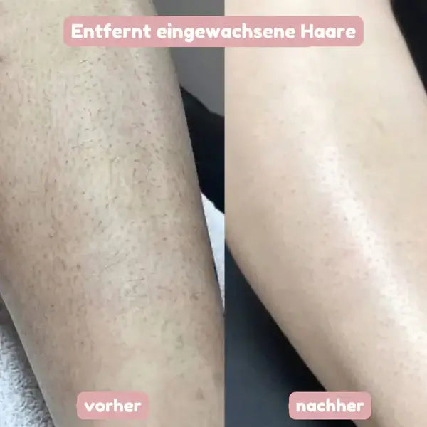 2-in-1 Damenrasierer für glatte, sanft gepflegte Haut