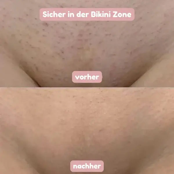 2-in-1 Damenrasierer für glatte, sanft gepflegte Haut