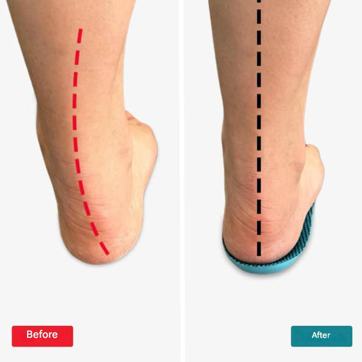 Orthopädische Einlegesohlen – StepRelief