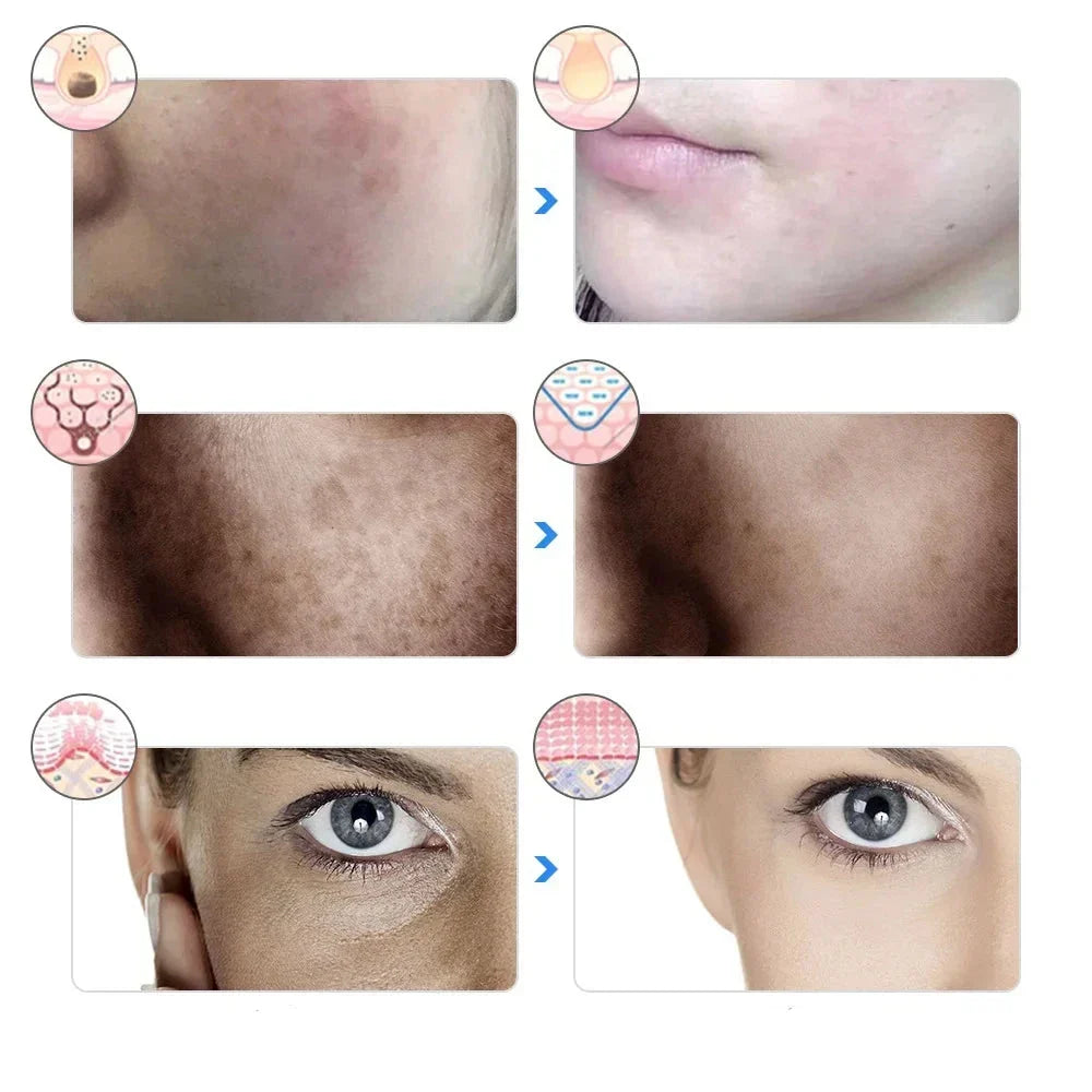 Altersglühen - 7 -Farben -LED -Therapiemaske für Gesichtsaufhebung und Aufhellung