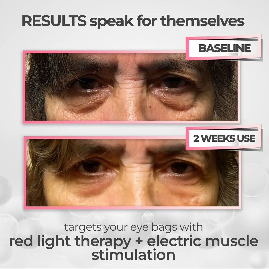LumaNova Eye Rejuvenator für Rotlicht- und Mikrostrom-Therapie