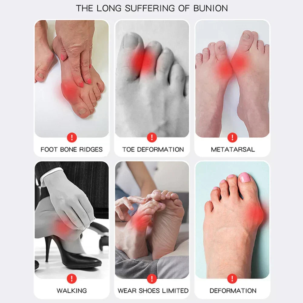 1+1 GRATIS | Hallux Valgus™ | Deine komfortable Lösung für schmerzfreie Füße!