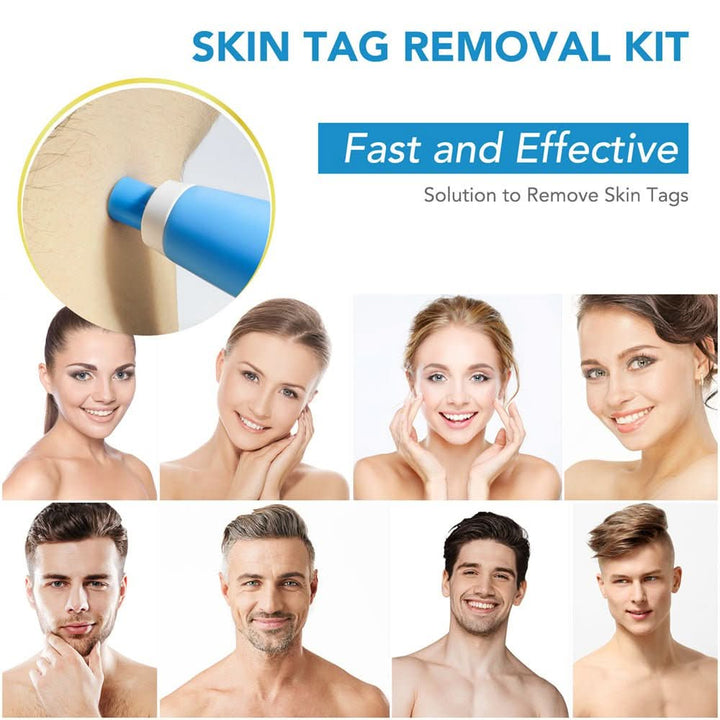 Dermaswift – Hautflecken entfernen gegen Warzen und Hautwucherungen