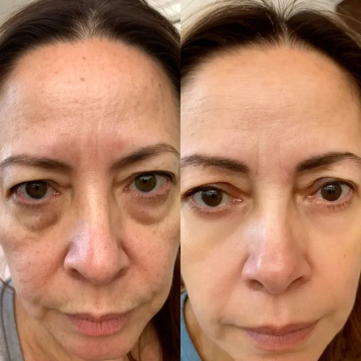 LumaNova Eye Rejuvenator für Rotlicht- und Mikrostrom-Therapie
