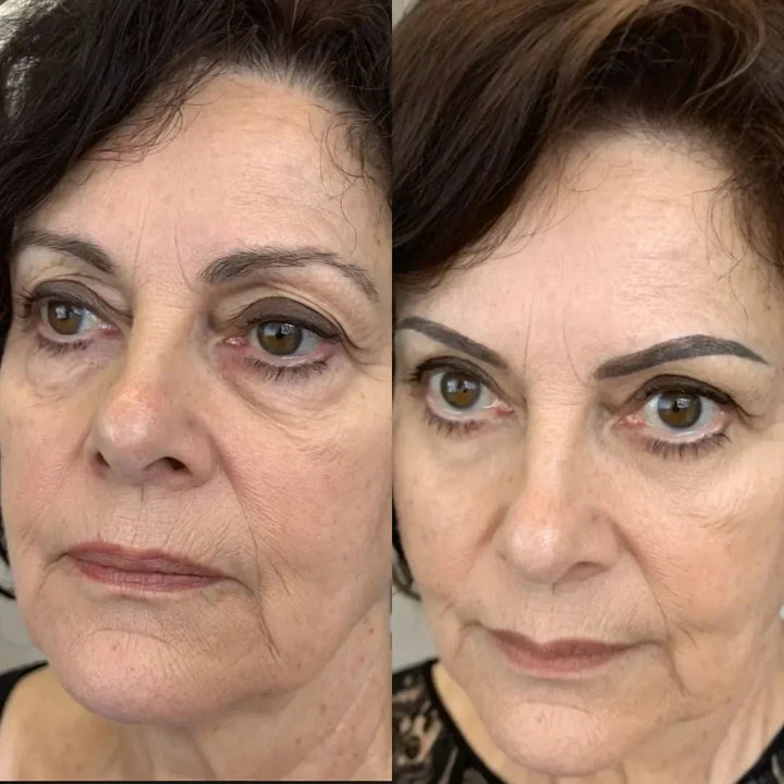 LumaNova Eye Rejuvenator für Rotlicht- und Mikrostrom-Therapie