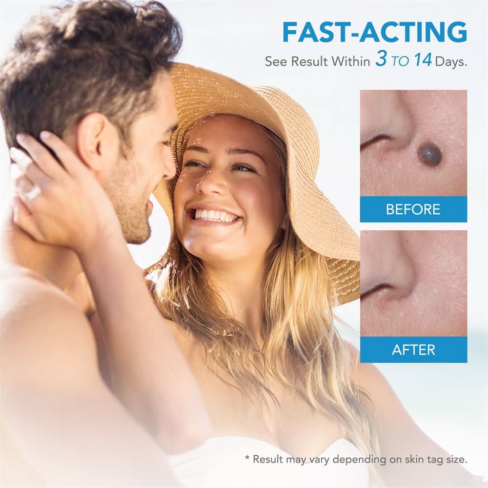 Dermaswift – Hautflecken entfernen gegen Warzen und Hautwucherungen