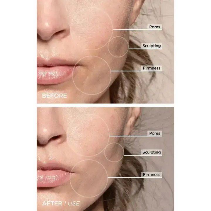 LED-Gesichtslifting- und Massagegerät 7-in-1 – Vénera