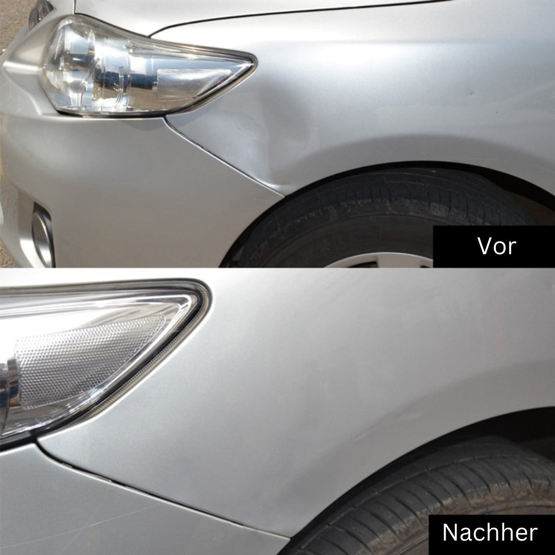 Dellenentferner-Werkzeug | Dellen und Beulen vom Auto entfernen | DellenMeister
